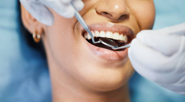 Best Emergency Dental Care for Sports Injuries in Botkins, OH