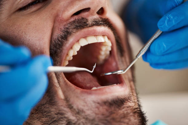 Best Broken or Chipped Tooth Repair in Botkins, OH